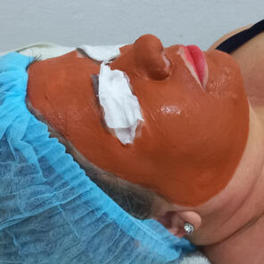 Estética Facial